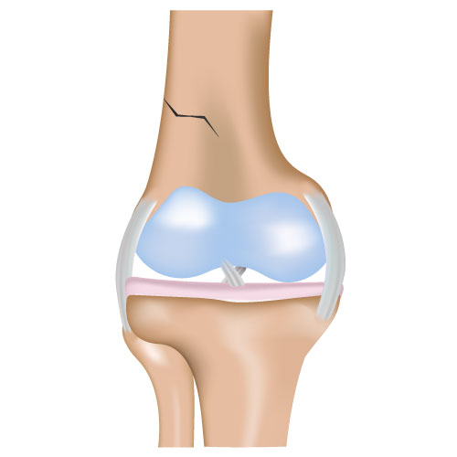 Michigan-Orthopedic-Center-Lansing-Okemos-MI