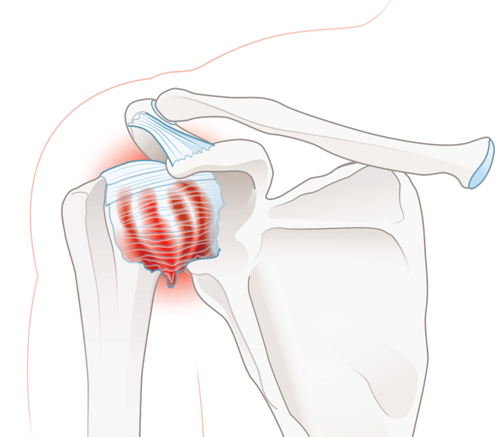 Michigan-Orthopedic-Center-Lansing-Okemos-MI