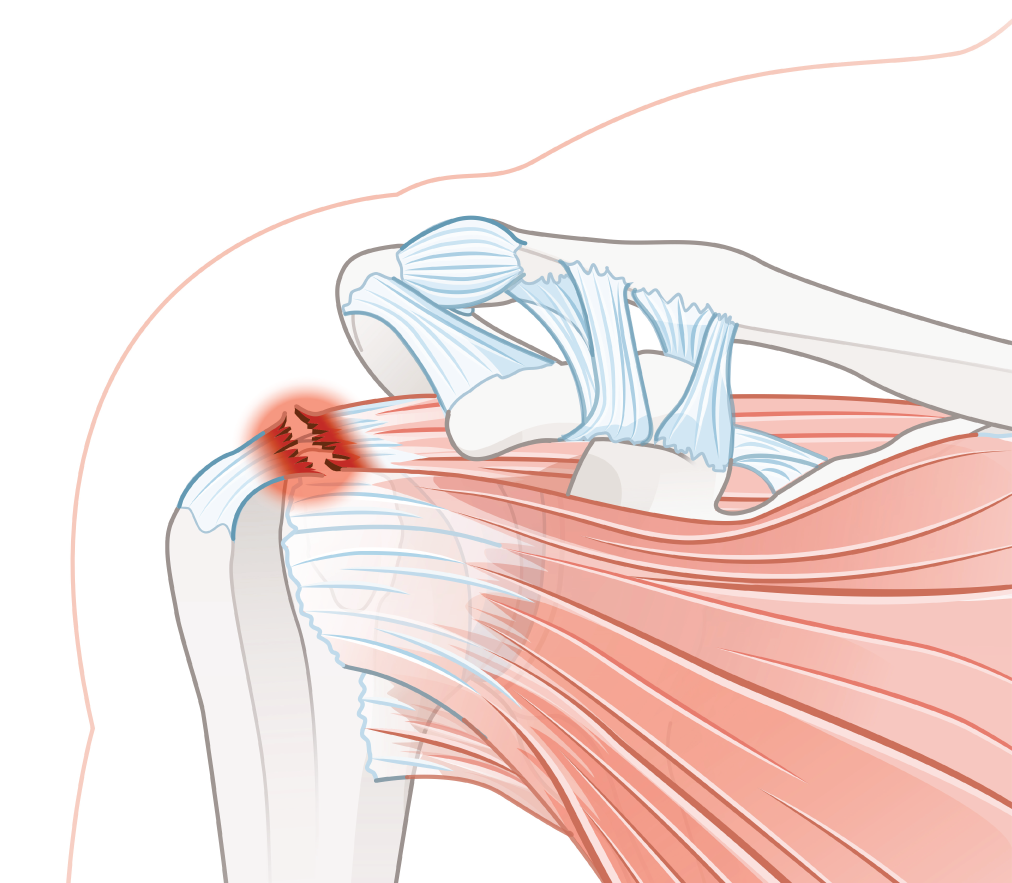 Michigan-Orthopedic-Center-Lansing-Okemos-MI