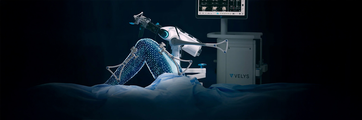 A Smarter Approach to Knee Replacement
